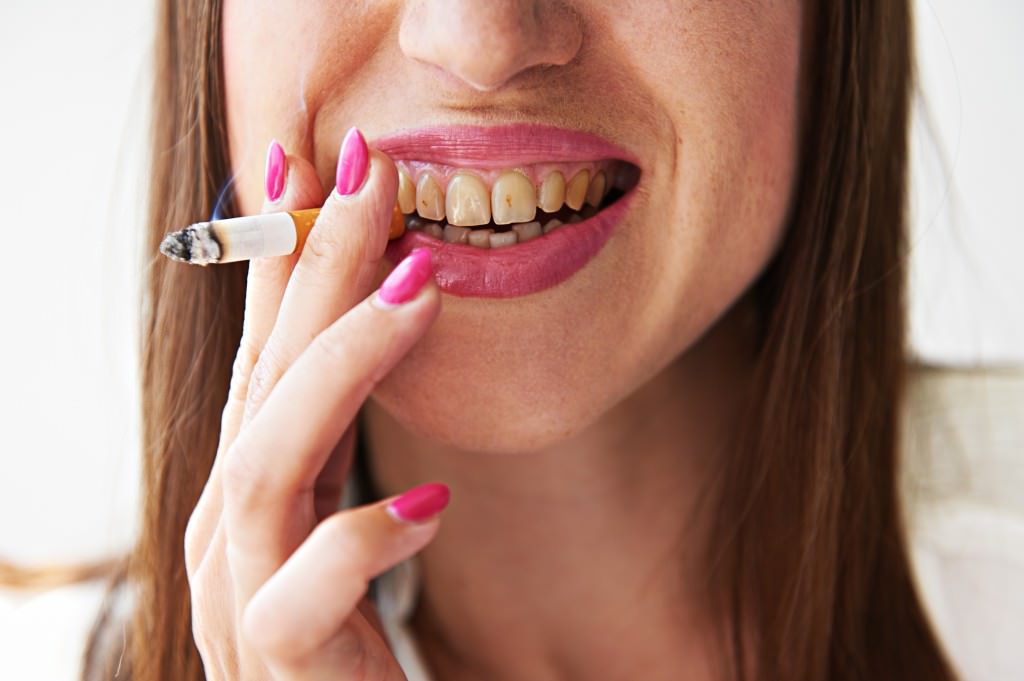 a dohányzás hatása a fogakra leszokni a dohányzásról ahogy a test megváltozik